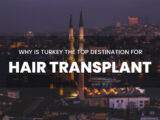 Text saying Why is Turkey the Top Destination for Hair Transplant with Istanbul in the background