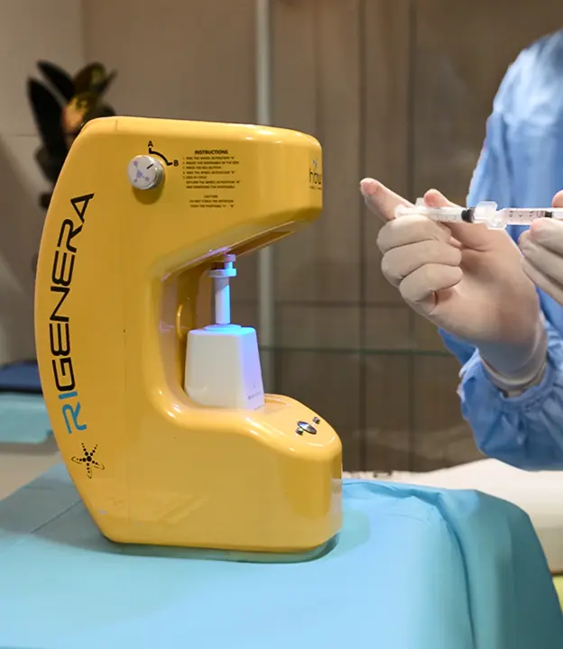 Stem Cell Hair Therapy
