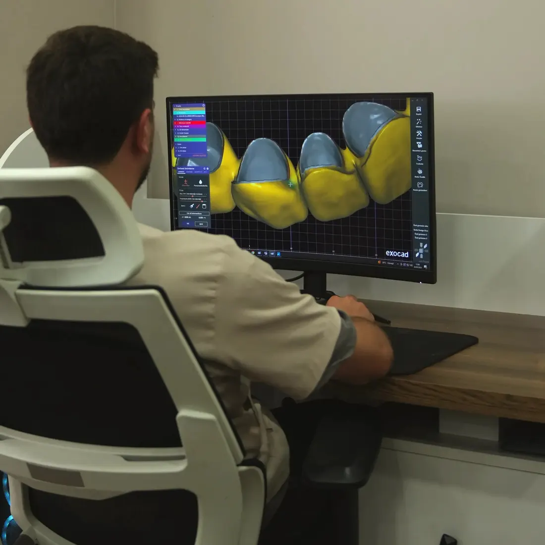 Crowns designed digitally at a partner clinic lab